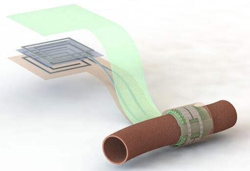 上圖描繪了這款可生物降解的壓力傳感器，它圍繞著一根血管，天線在左側(cè)(分離的層狀結(jié)構(gòu)，展示了天線結(jié)構(gòu)的細(xì)節(jié))